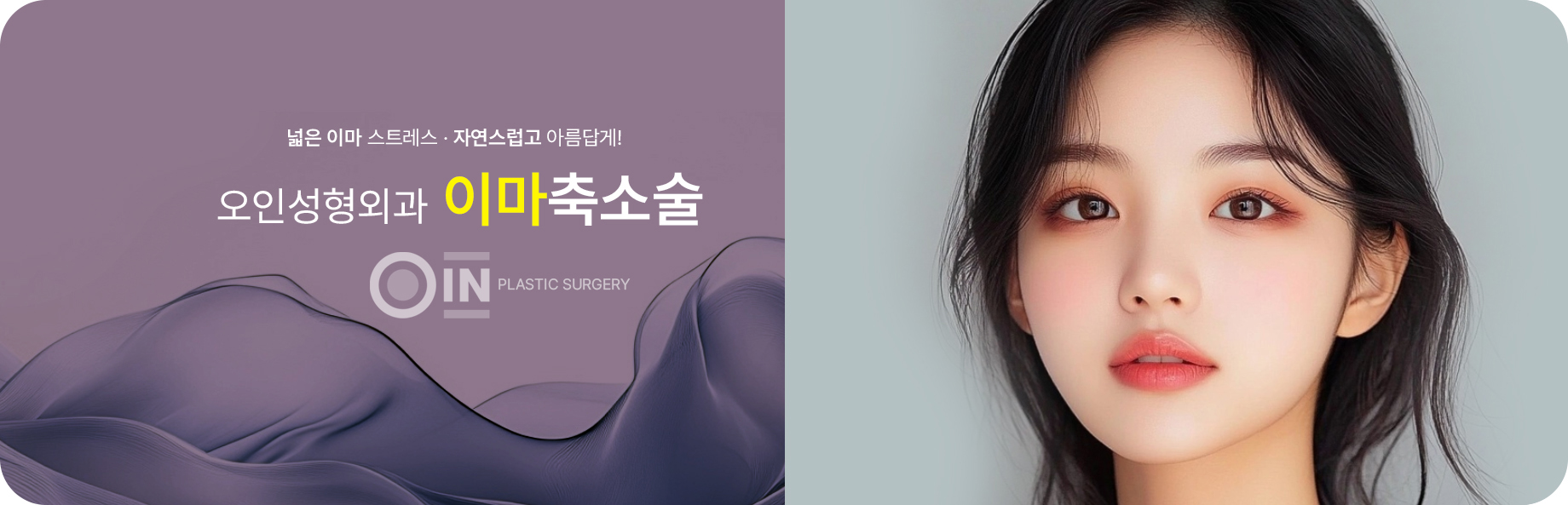 넓은 이마 스트레스, 자연스럽고 아름답게! 오인성형외과 이마축소술