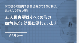 모든 형태의 사각턱에서 효과가 우수